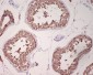 Anti-GRP78 BiP HSPA5 Rabbit Monoclonal Antibody